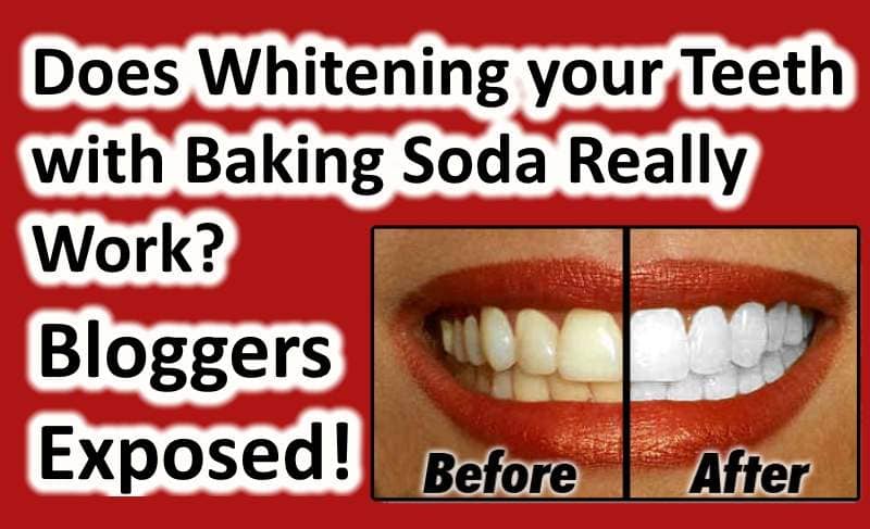 Demon Kauwgom brug Hoe helpt baking soda ons om wittere tanden te krijgen? - AlexWater&Bouw